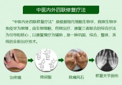 治疗痛风所用的“中医内外四联修复疗法”都有哪些特点？